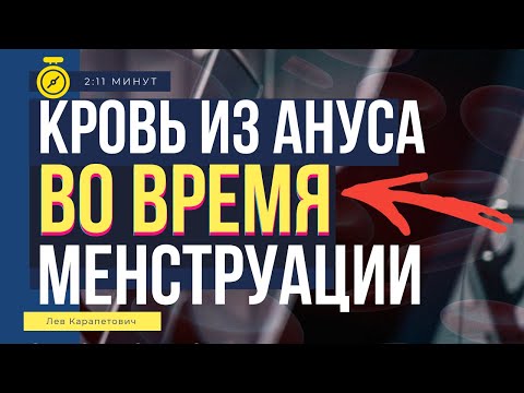 ВО ВРЕМЯ СТУЛА, в период менструации ЛЬЕТСЯ КРОВЬ. Что это? Геморроидальная болезнь колопроктолог