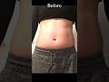『ウエストBefore After 11連発』　waist Before and After 11 series