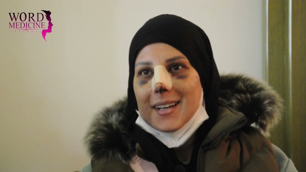 WORD MEDICINE | RHINOPLASTY OPERATION REVIEWS