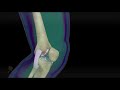 Knee Medical animation