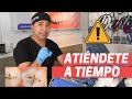 Tratamiento de caries sin dolor | Dr. Alvaro Campos