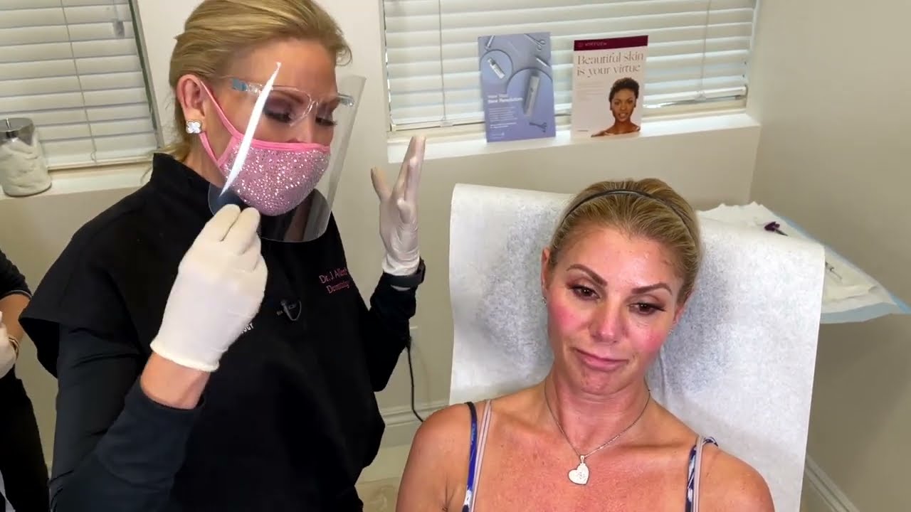 RHA Filler Used on Real Patients