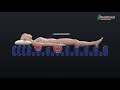 How Does Medical Air Mattress Work? | Hospital Bed Air Mattress Manufacturer【Roodinseat】