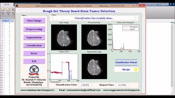 Brain Tumor Detection using Rough Set Theory Matlab Source Code