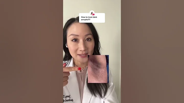 Causes of Dark Armpits | Dermatologist Tips #SHORTS