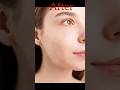 make pimple free image and make clone #photoshop #graphic design #shorts