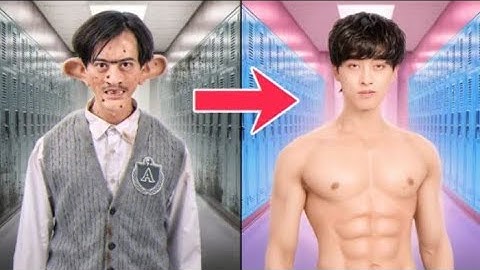 Ugly Boy Becomes Handsome Overnight |Alan