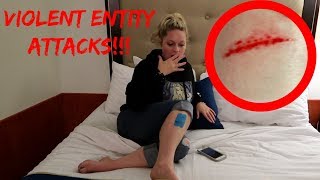 Attacked By A Ghost On The Queen Mary!!! **Room B-340**