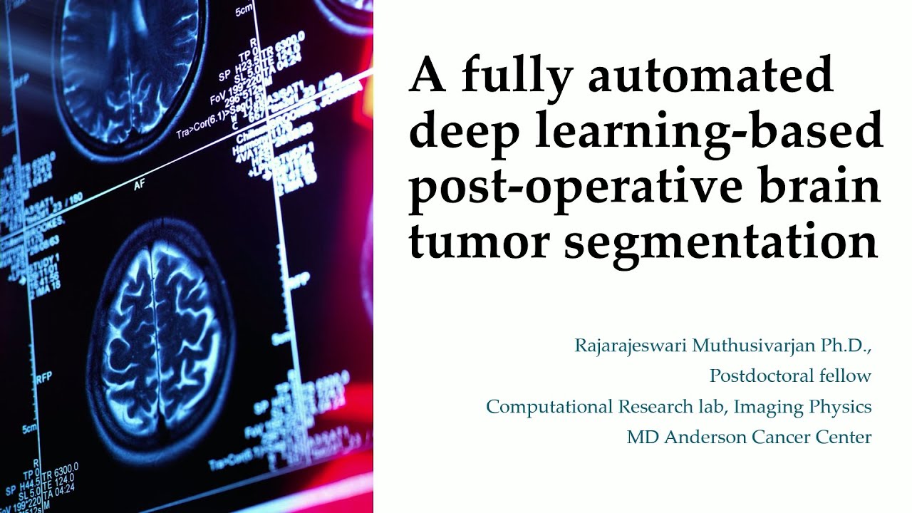 Technical Talk: A Fully Automated Deep Learning-Based Post-Operative Brain Tumor Segmentation