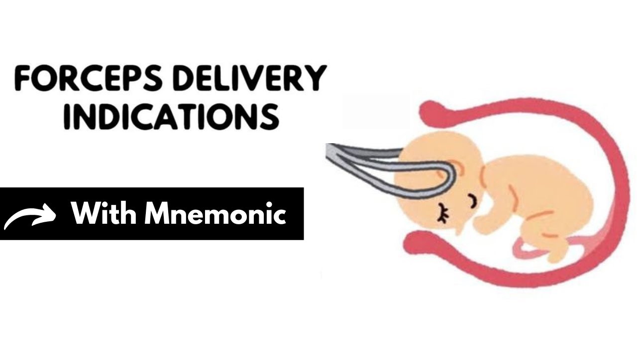 Forceps Delivery Indications With Mnemonic Obstetrics Mnemonics Dr