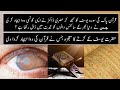 How Quran Helped Egyptian Scientist Develop A Revolutionary Medicine | Urdu / Hindi