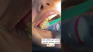 الجنب الي مبنكلش عليه نتيجة عدم استعمالة بيجمع جير كتير #teeth #toothpaste #caries