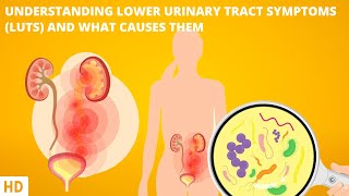 Understanding Lower Urinary Tract Symptoms screenshot 5