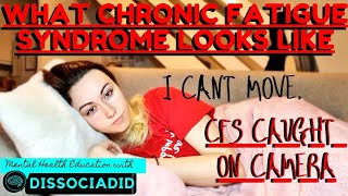 WHAT CFS LOOKS LIKE CAUGHT ON CAMERA | CHRONIC FATIGUE SYNDROME/MYALGIC ENCEPHALOMYELITIS