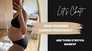 Rainy day chat | Skin changes during pregnancy | Jasmine Tookes
