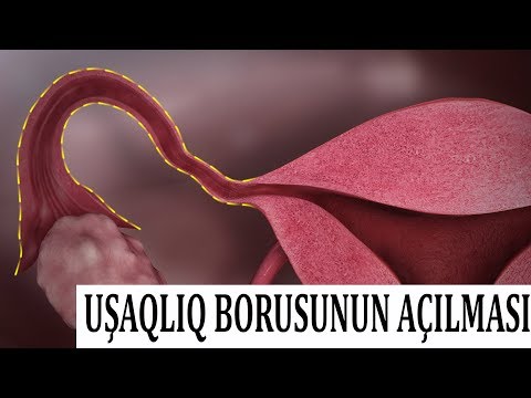 Video: Boru sıxacları nədir?