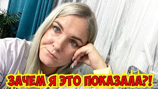 🤦‍♀️ЗАЧЕМ Я ЭТО ПОКАЗАЛА? ПРО ОПЕРАЦИЮ. К ПОДРУГЕ В ГОСТИ