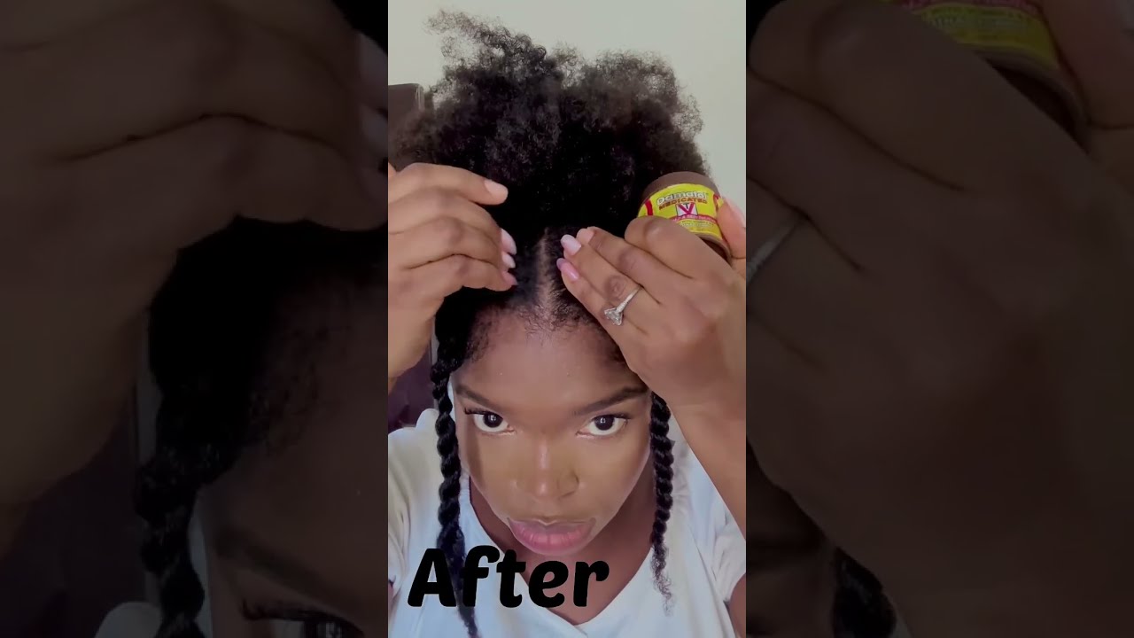 Grow Back Thinning Edges Growedgesfast
