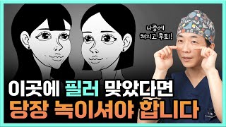 '이 곳'에 필러 맞았다면 지금 당장 녹이셔야 합니다. 나중에 무조건 후회해요.