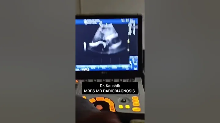 Dr. Kaushik MBBS, MD RADIODIAGNOSIS || Radiologist || Radiology life #neetpg2022 #neet2022 #shorts