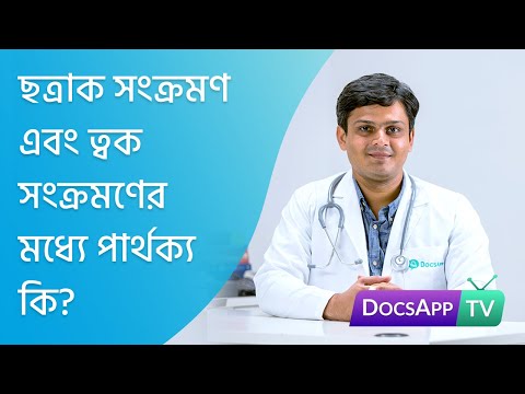 ছত্রাক সংক্রমণ এবং ত্বক সংক্রমণের  মধ্যে পার্থক্য কি?  #AsktheDoctor