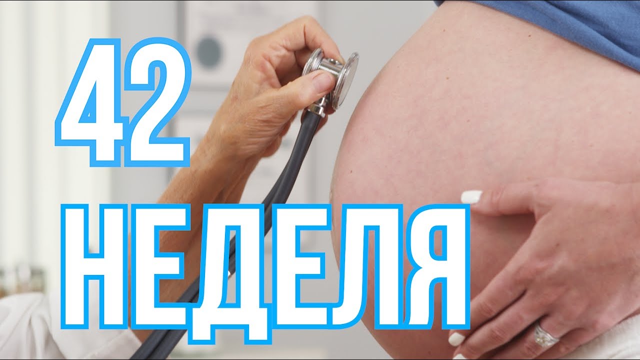 Родить 41 неделя