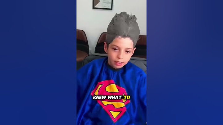 Hair Dye Disaster! The Result Will Shock You 😱💇‍♂️ #shorts #fail #hair