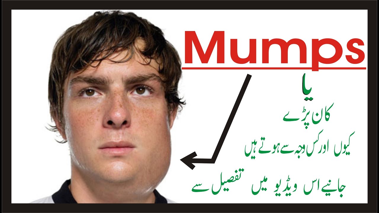 Mumps meaning