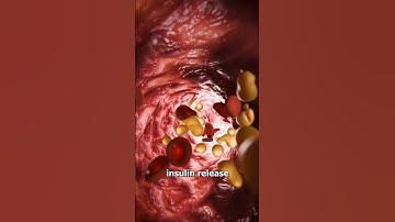 How An Insulin Patch Works 🤔