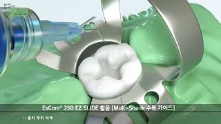 [SPIDENT] EsCom250 EZ Slide (국문/ Korean)