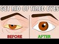 How to naturally get rid of tired eyes in 2 easy steps
