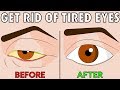 download How to naturally get rid of tired eyes in 2 easy steps - Austin Goh download How to naturally get rid of tired eyes in 2 easy steps - Austin Goh