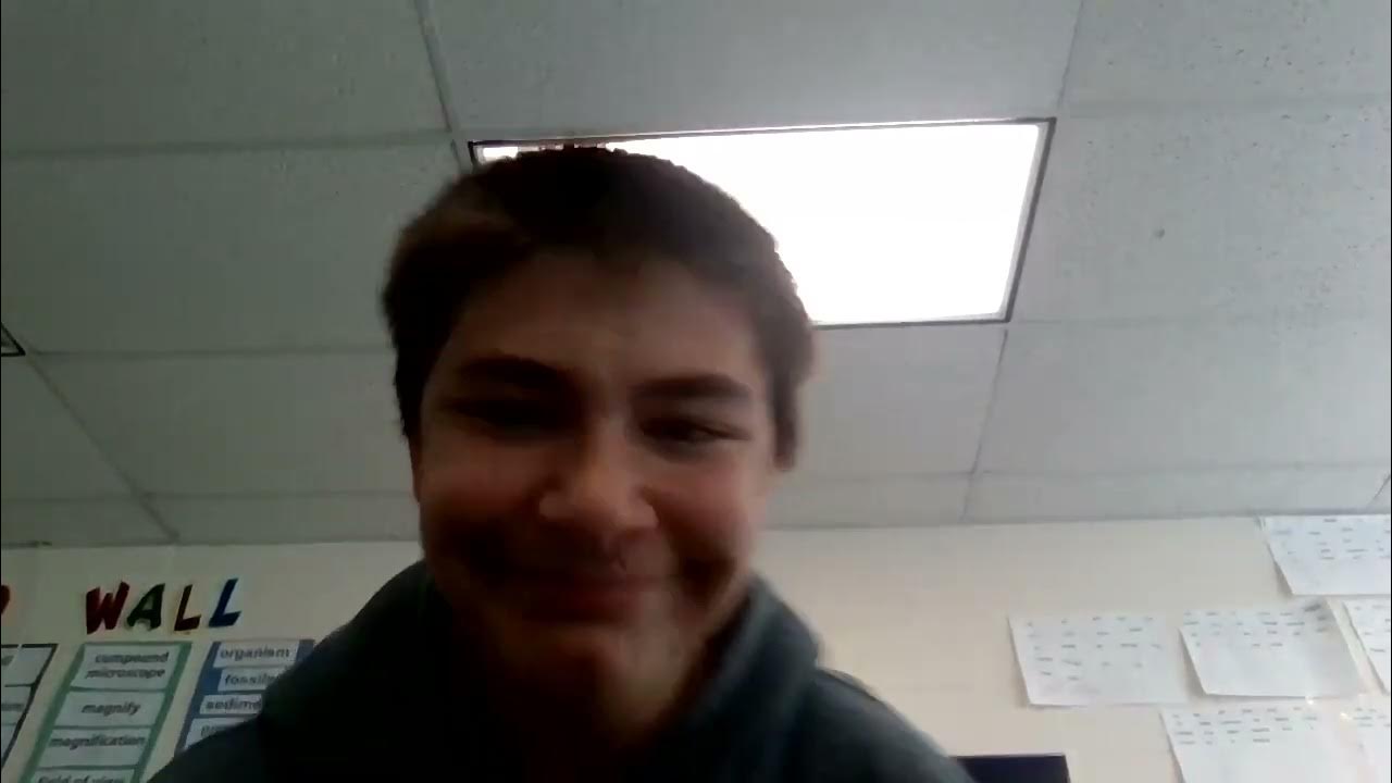 autistic kids stares camera on while moving his head back and forth