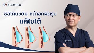 ซลโคนขยบ หนาอกผดรป แกไขได