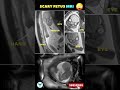 Baby MRI | Fetal scan | Pregnancy week by week #pregnancy #mri #sonography