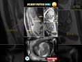 Baby mri  fetal scan  pregnancy week by week pregnancy mri sonography