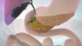 The gallbladder and bile ducts | Cancer Research UK thumbnail