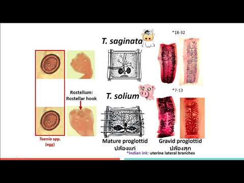 ทบทวนความรู้ปรสิตวิทยา เพื่อสอบใบประกอบ MT