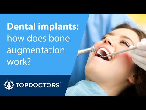 Dental implants: how does bone augmentation work?