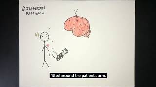 Using brain-computer interface to restore arm movement after a stroke