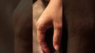 Twitch Spasm Index Finger Hand Uncut