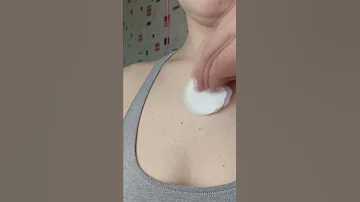 Как избавиться от прыщей. Самый действующий способ.