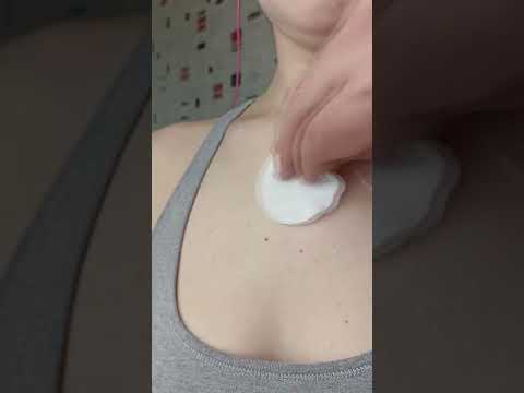Видео: 3 способа избавиться от сыпи под грудью