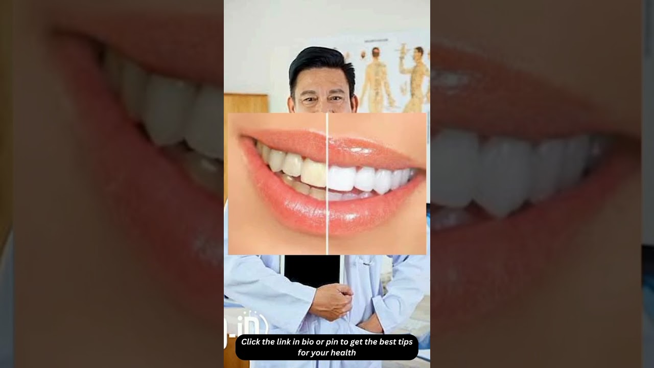 🌟 ProDentim Review: Transform Your Smile Naturally! 🦷✨