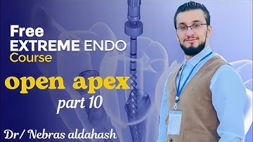 Management Of immature Tooth || Open apex