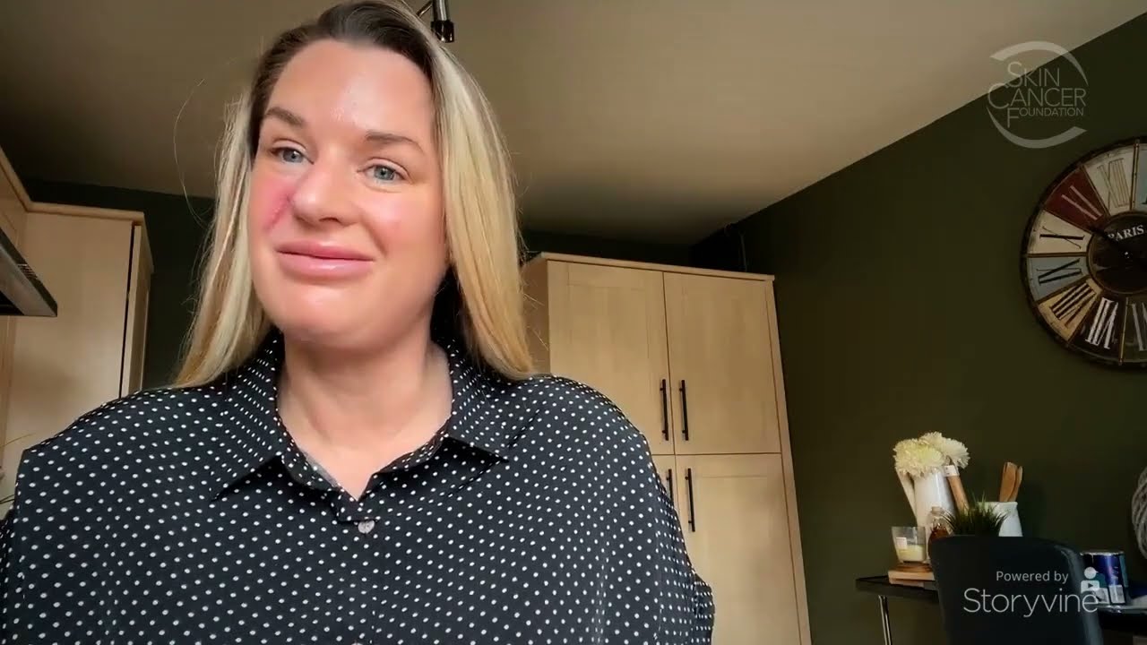 Skin Cancer Is Serious: Annie Wilson Part 2