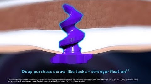 ReliaTackᵀᴹ articulating reloadable fixation device with standard and deep purchase tacks - 4/5