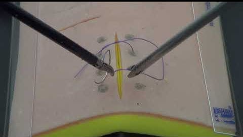 Laparoscopic Suturing Szabo Knot Demo video