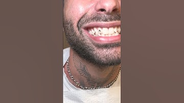 Discover the latest trend of tooth gems 💎