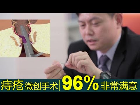 激光雷射痔疮手术知多点 (Laser Piles Treatment)︱影片包含了各种痔疮治疗方法 – 马来西亚外科专科医生